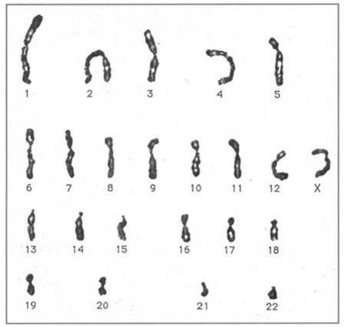 chromosomes et caryotypes